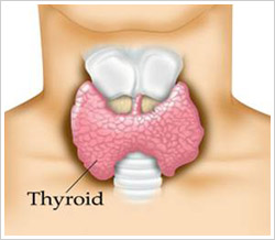 People living in volcanic areas ‘at increased thyroid cancer risk’