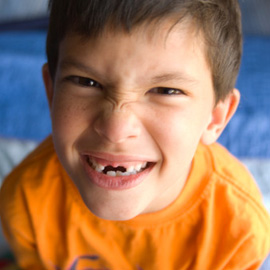 A tooth may be knocked out in many ways