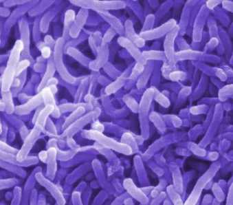 Two dogs were found infected with cholera bacteria in Vietnam