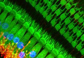  Hair cell offers easy way to make patient-specific heart cells for disease modelling