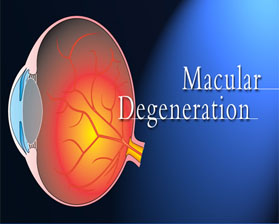New hope for the elderly suffering from AMD