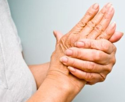 arthritis