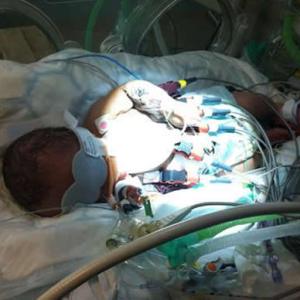 UK baby saved by being freezed for 4 days 