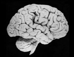 The brain saves energy by forecasting what it is likely to see 
