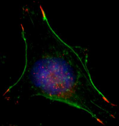 breast-cancer-cell-in-normal-oxygen