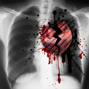 Scientists try to mend ''broken heart syndrome''