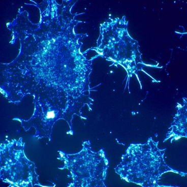 Targeting cancer cell metabolism can lead to more effective therapy