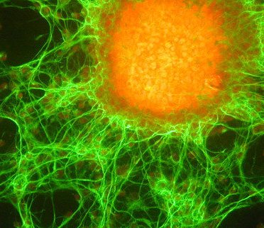 Specific stem cells within tumors responsible for cancer's growth, research