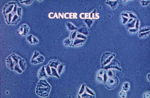 Cancer cells have an "escape tactic" which can outwit potent caner drugs