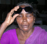 Nine persons lose vision after cataract surgery in Tamil Nadu