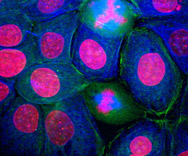 enzyme-cancer