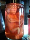 fetus in jar