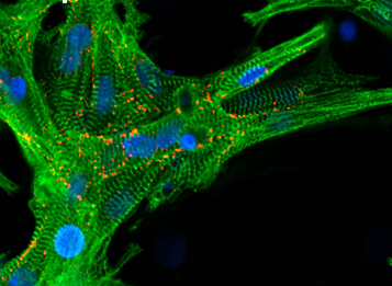 Voila! Scientists build heart tissue that beats