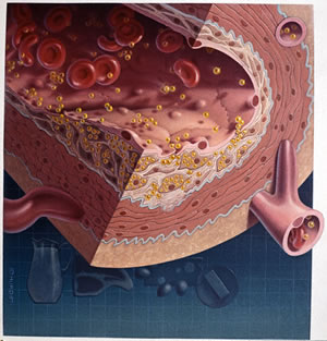  Protein controls ''bad'' cholesterol levels outside cells