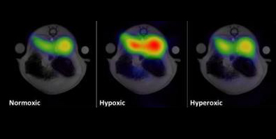 hyperpolarisation-method