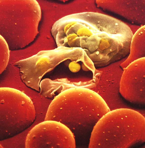 New way to ‘tame’ malaria parasite identified