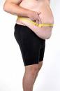  Doctors have less respect for obese patients: Study