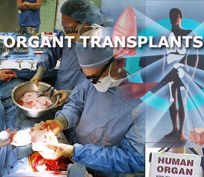 DOH issues warning over infected organs for transplants