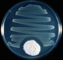 Certain antibiotics may be safe to use during pregnancy: Study