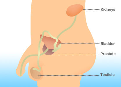 prostate cancer spread to