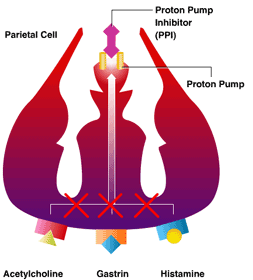 Proton pump inhibitor use in reflux disease may lead to unexpected consequences