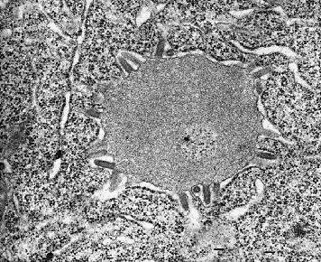 Rabies virus found to be potent cancer killer