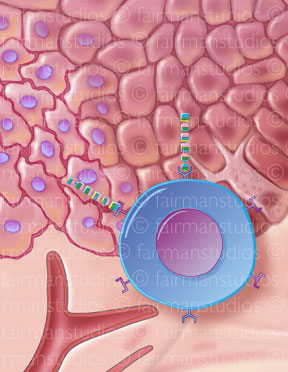 Skin cells can predict cancer risk elsewhere in body