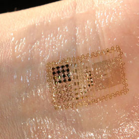 Soon, tattoo-like electronic patch on skin to monitor patients’ health