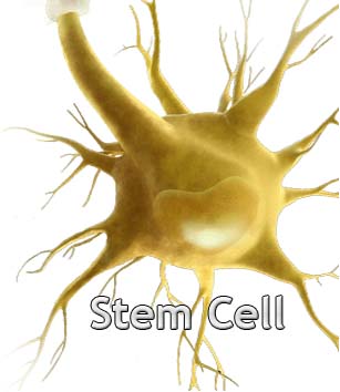 stem cell therapy