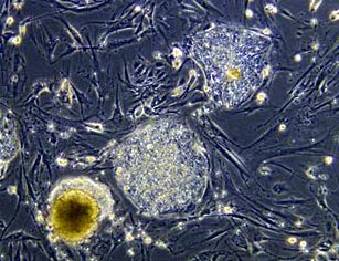 stem cell