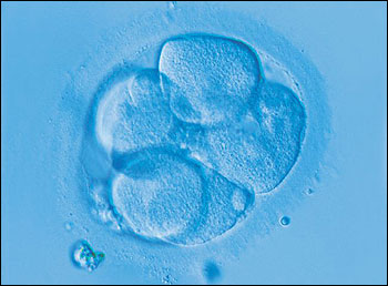 stem-cells-bone
