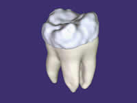 New discovery may help repair damaged tooth enamel