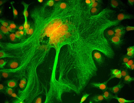 tumour-cells