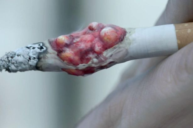 /tumours-on-cigarettes.jp