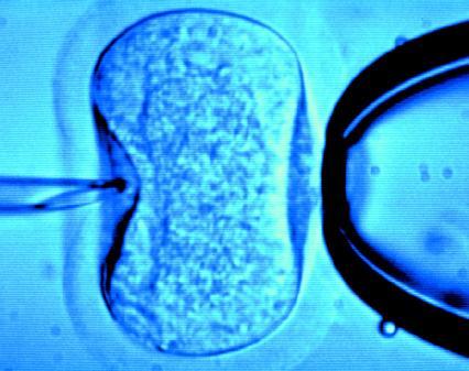 IVF success lower in women who used alternative fertility treatment