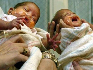Over 400,000 babies die within day of birth in India