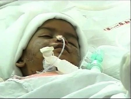 Two-year-old Falak dies at AIIMS trauma center