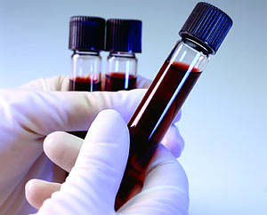 Blood samples yield clues to help fight cancers