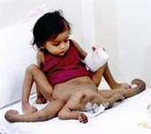 Eight-Limbed girl Lakshmi
