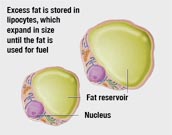 Fat cells of obese person are sick as compared to fat cells of lean person