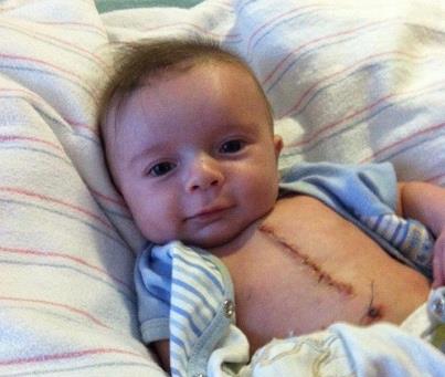 3-month-old open-heart surgery survivor becomes latest Internet sensation