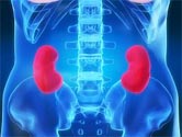 Patients with kidney stones at higher chronic kidney disease risk