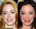 A New Trend In Plastic Surgery  