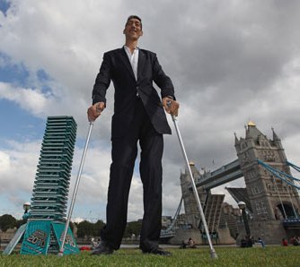 Pituitary Tumour Caused World’s Tallest Man’s Gigantism 