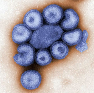Software Engineer is the latest victim of swine flu in Orissa