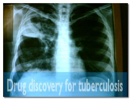 TB enzyme’s discovery brings new drug therapies closer to reality