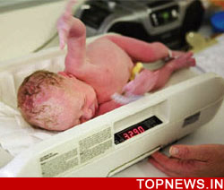 Why thalidomide causes severe birth defects revealed