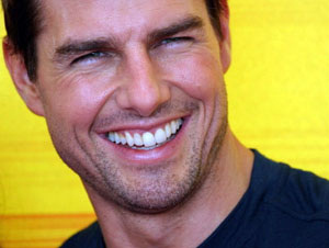 Tom Cruise-like smile comes with a ‘sunburn’ price tag