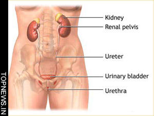 Urinary tract infections are easily treatable