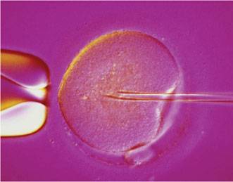 Women Lose Almost 90 Per Cent of Their ‘Eggs’ By the Age of 30